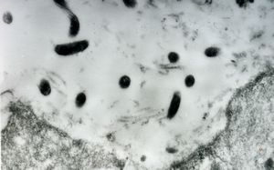 F,52y. | colon … spirochetosis … subepitheliai microbes F,52y. | colon … spirochetosis … subepitheliai microbes